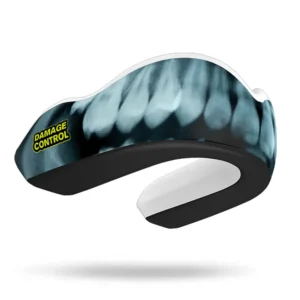 damage control mouthguard x ray extreme impact 1